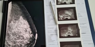 Why the Federal Breast Density Notification Law Marks a Turning Point for Women’s Health getty-images-AXd8LmIRm2Y-unsplash.jpg