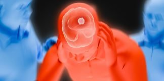 Approved Cancer Drugs May Have Potential to Treat Hemorrhagic Stroke
