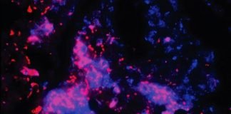 Navitoclax May Streamline Standard Tuberculosis Treatment and Prevent Post-TB Lung Disease.