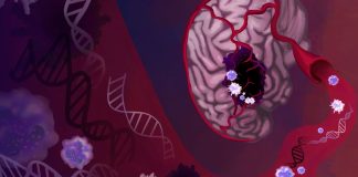 A Liquid Biopsy Guided by Artificial Intelligence (AI) Shows Promise in Detecting Brain Cancer