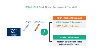 ESMO 2025: A ctDNA-guided Approach to Helps Personalize Adjuvant Chemotherapy Colon Cancer