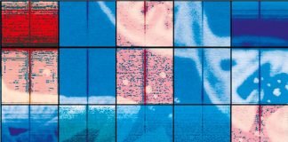 Study Shows that early DNA Breaks in BRCA Carriers Reveal the Beginnings of Breast Cancer