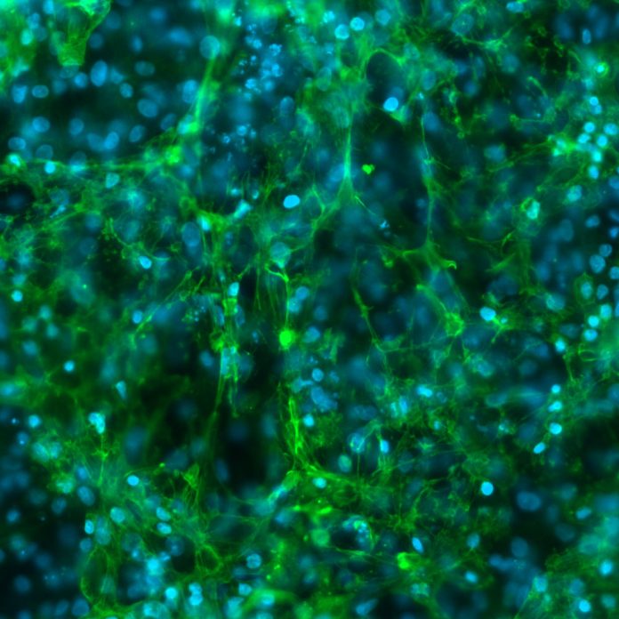 2602216-pr-dixon-cardiomyocytes