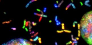 Scientistic Identify a Potential Novel Treatment for Glioblastoma