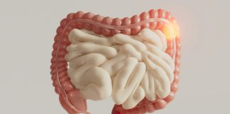 The ERASur Trial Surpasses One-Third Accrual: A Nationwide Effort to Define the Role of Total Ablative Therapy in Limited Metastatic Colorectal Cancer